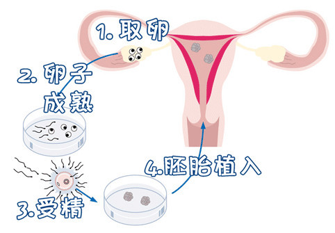 关于供卵代生网